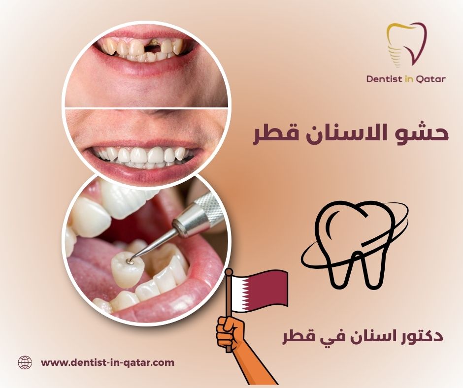 مركز زراعة الاسنان