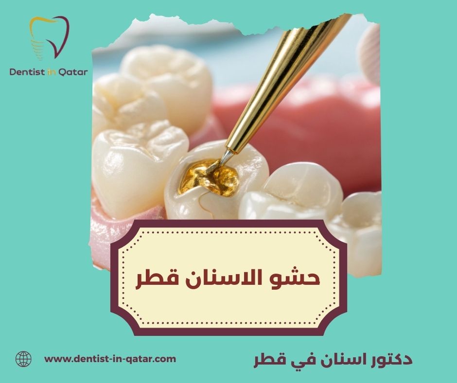 افضل عيادة اسنان قطر