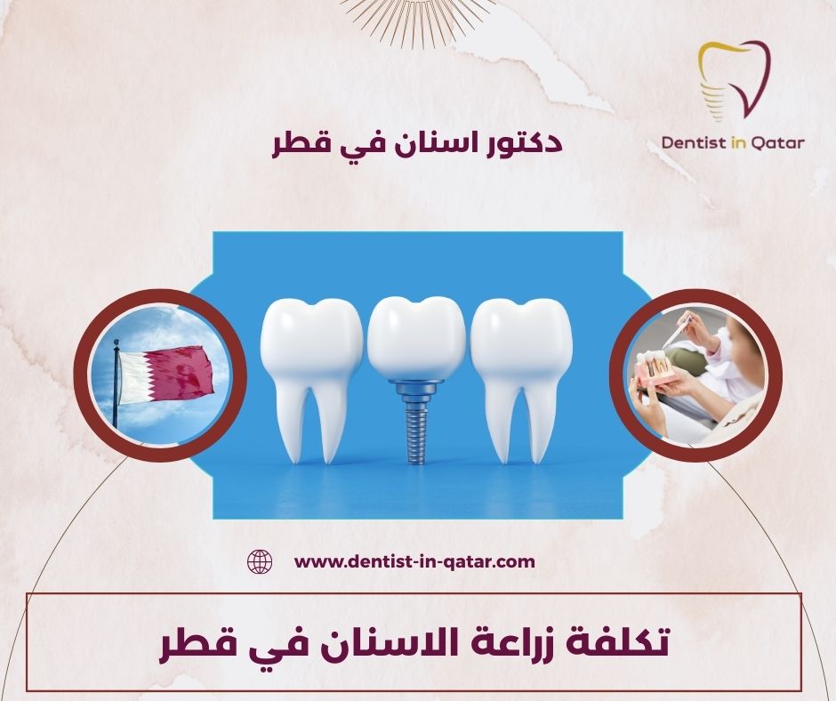 زراعة الأسنان الفورية في قطر