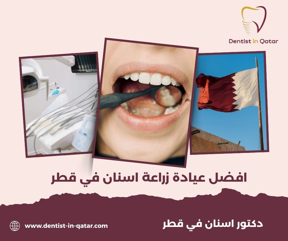 أفضل زراعة اسنان في قطر