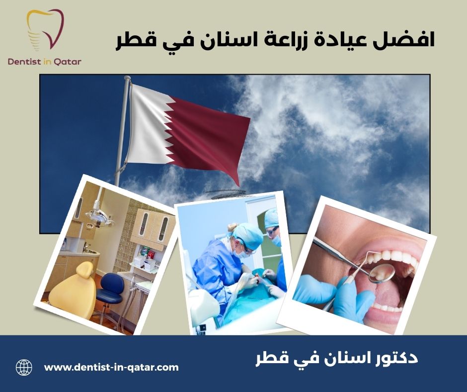 أفضل دكتور زراعة أسنان في قطر