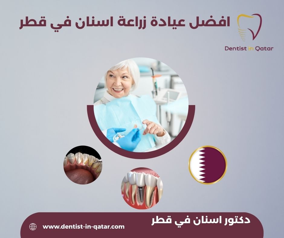 افضل دكتور زراعة أسنان في قطر