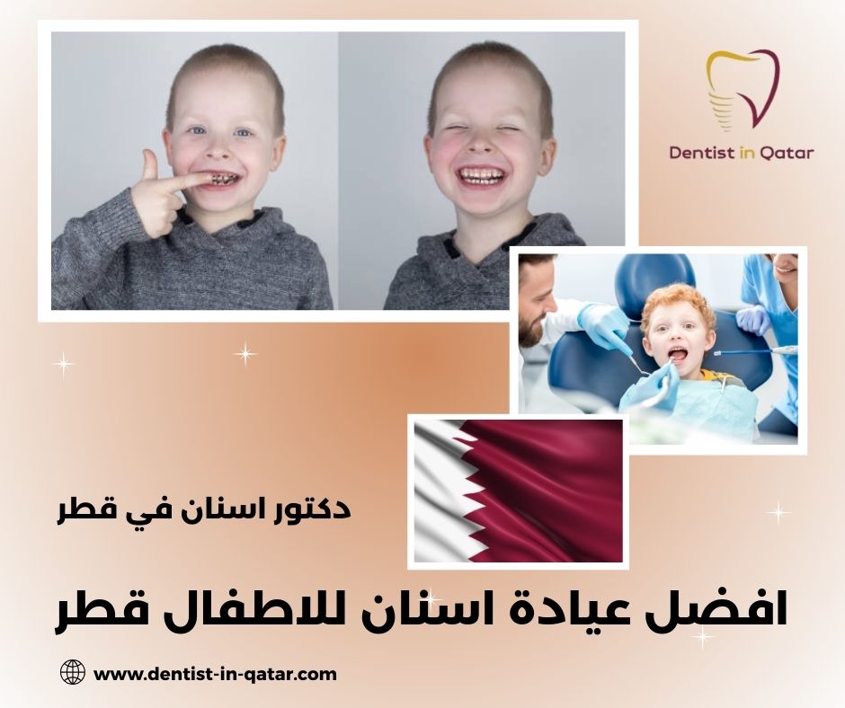 افضل عيادة اسنان للاطفال في قطر