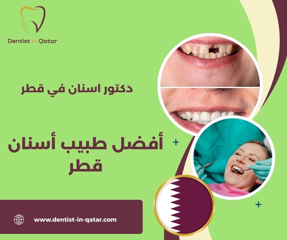 حشو الاسنان قطر