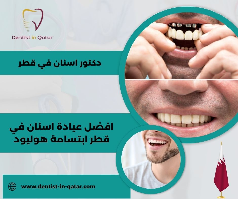 افضل عيادة اسنان في قطر ابتسامة هوليود