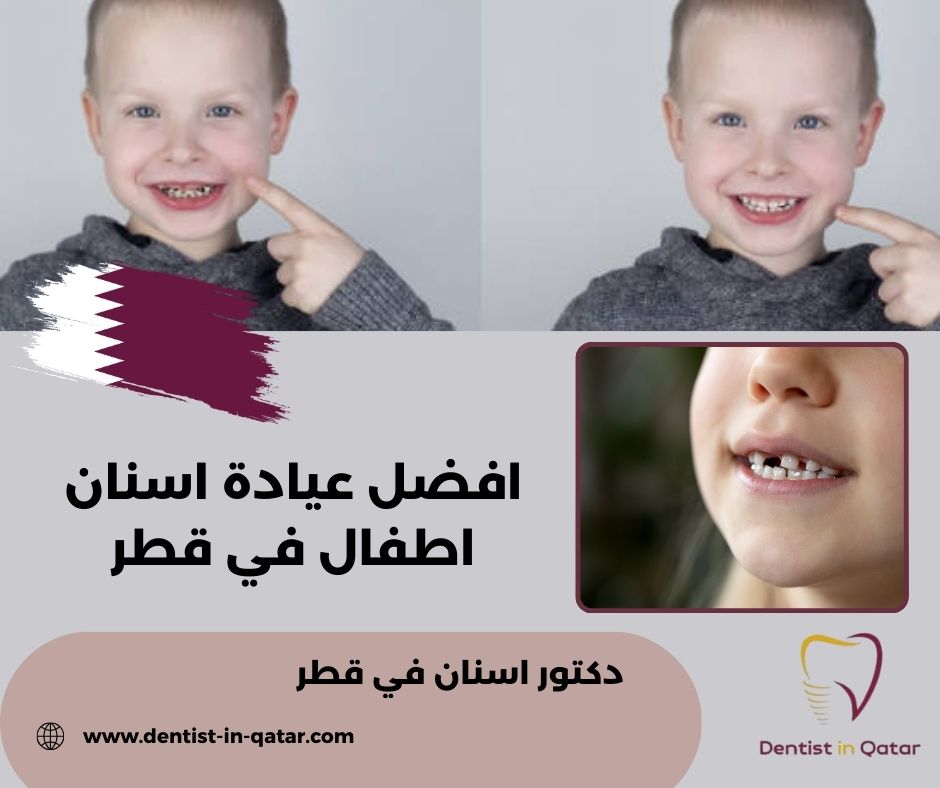 افضل عيادة اسنان اطفال في قطر