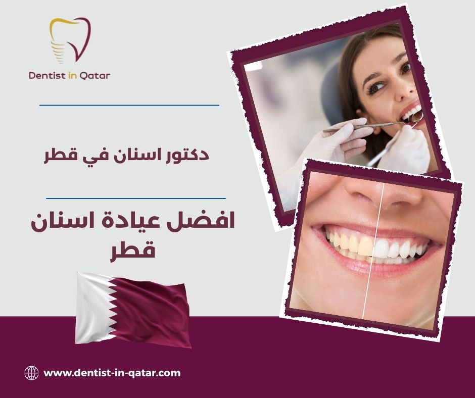 افضل عيادة اسنان قطر