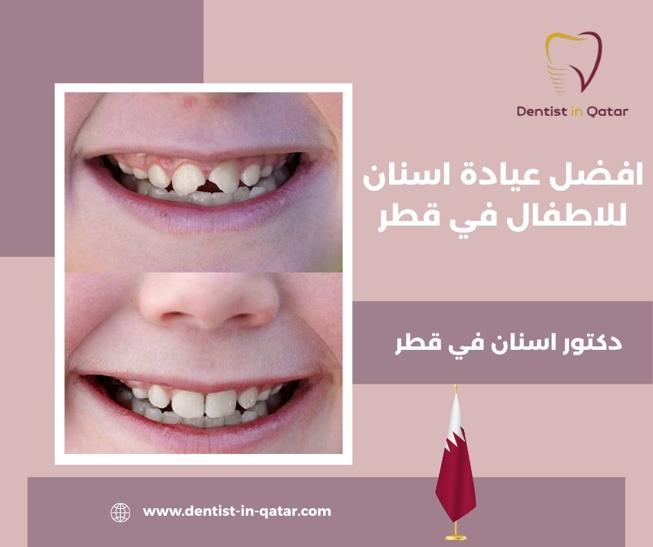 افضل عياده اسنان للاطفال في قطر افضل عياده اسنان للاطفال في قطر