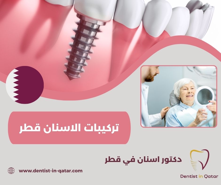 افضل عيادة اسنان قطر