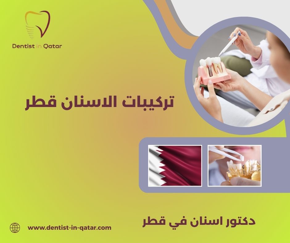 زراعة الاسنان قطر