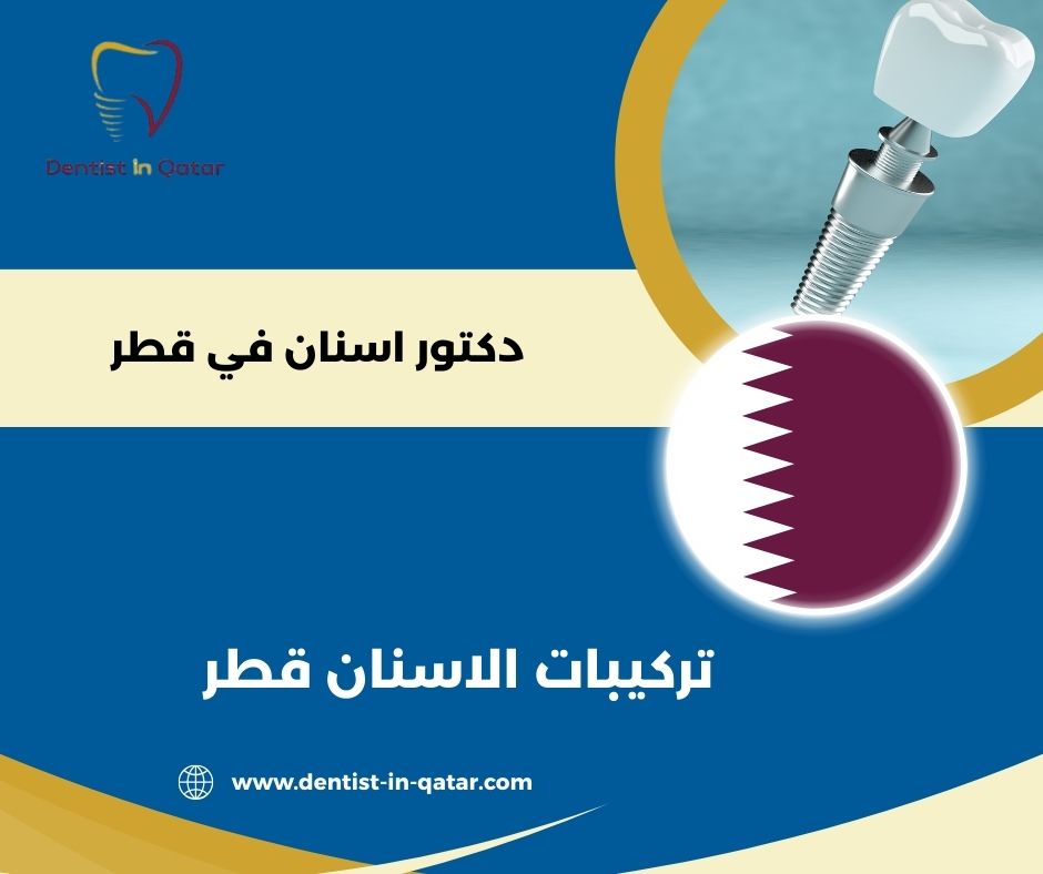 تركيبات الاسنان قطر