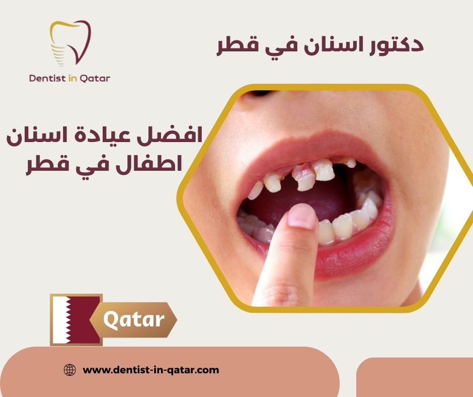 افضل عيادة اسنان اطفال في قطر
