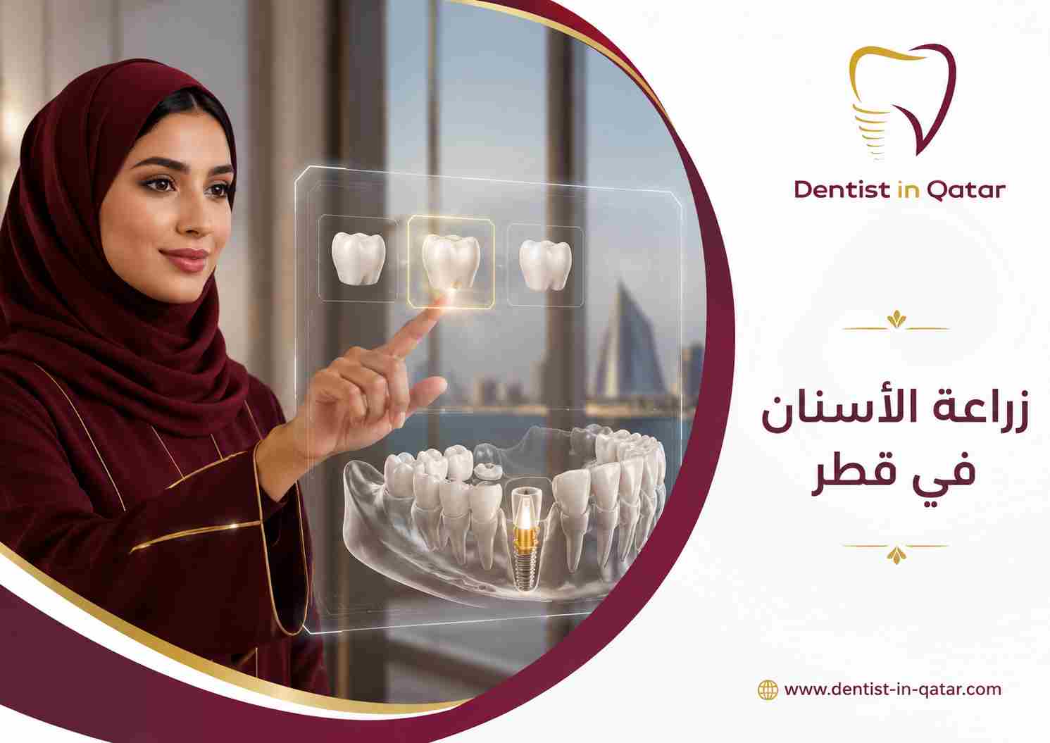 زراعة الأسنان في قطر