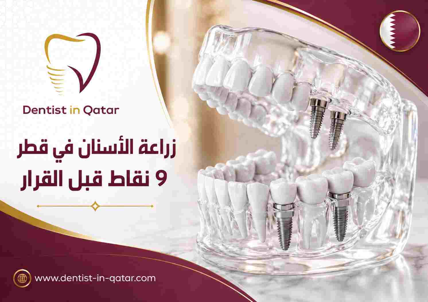 زراعة الأسنان في قطر