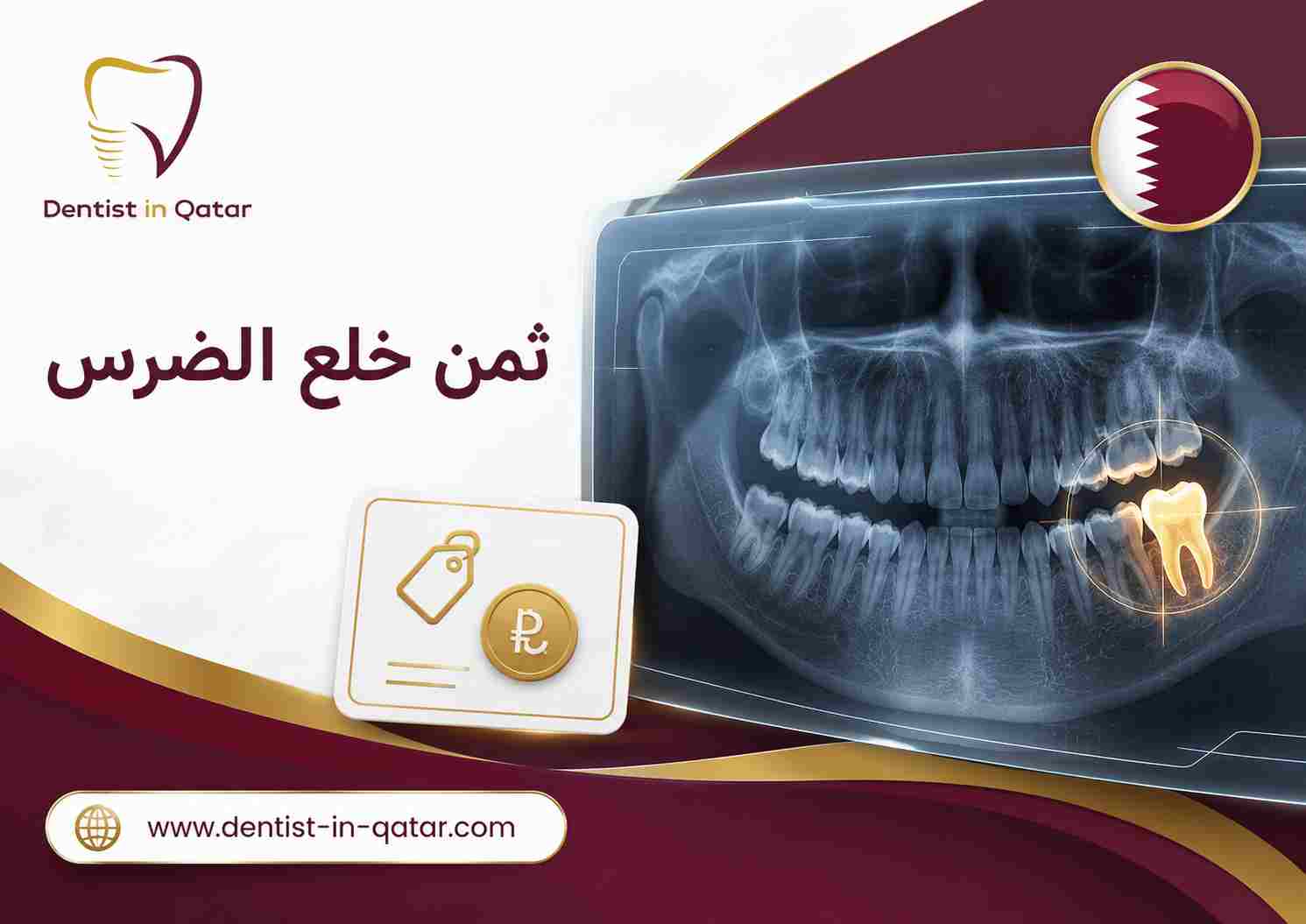 ثمن خلع الضرس
