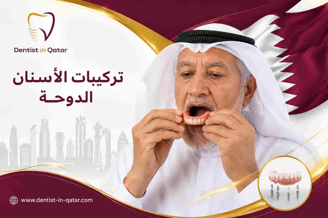 تركيبات الأسنان الدوحة