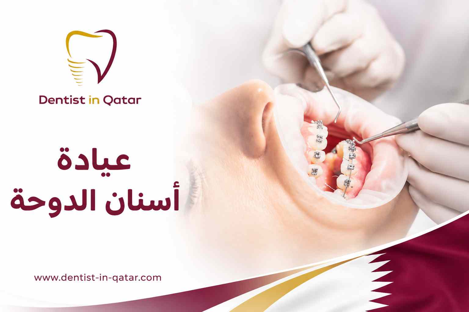عيادة أسنان الدوحة