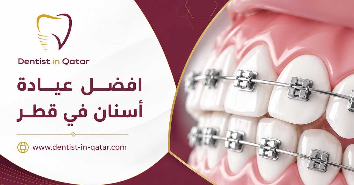 افضل عيادة أسنان في قطر افضل عيادة أسنان في قطر