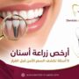 أرخص زراعة أسنان