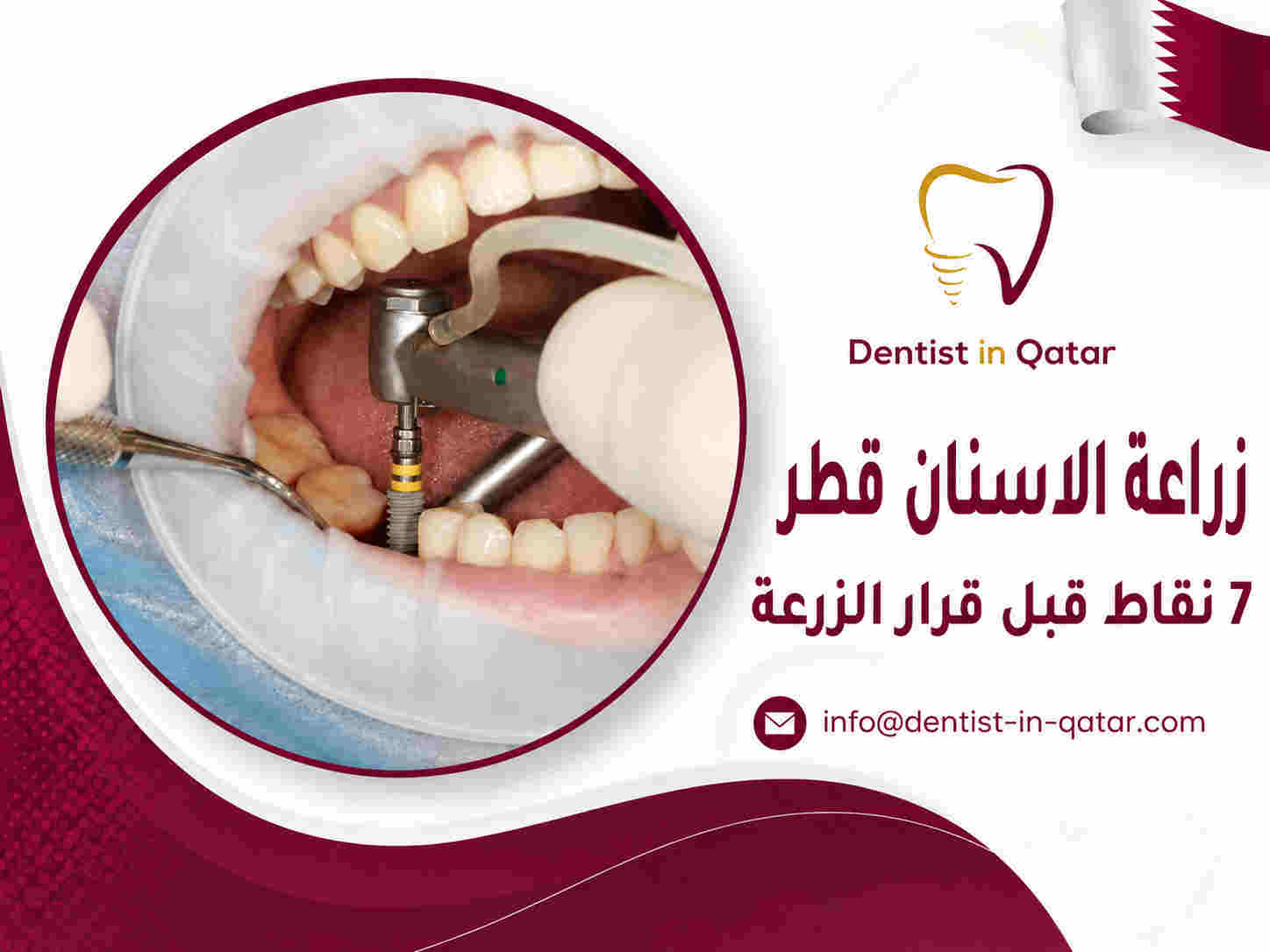 زراعة الاسنان قطر