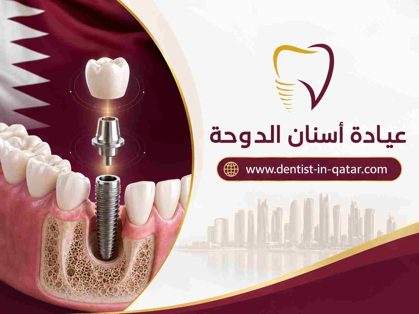 عيادة أسنان الدوحة