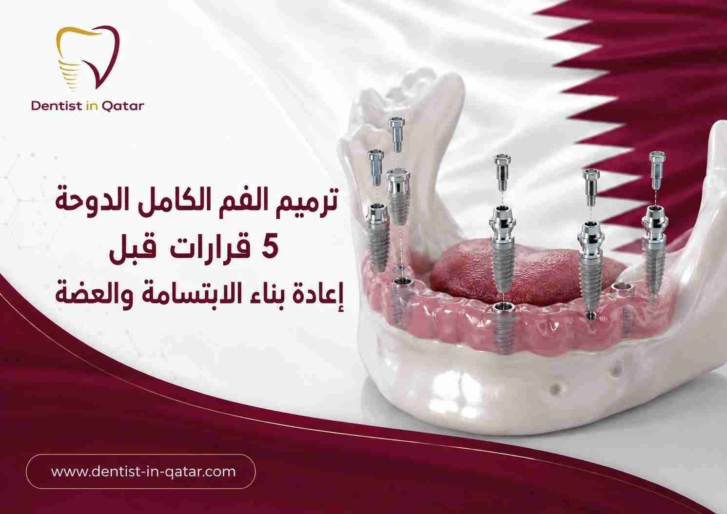 ترميم الفم الكامل الدوحة