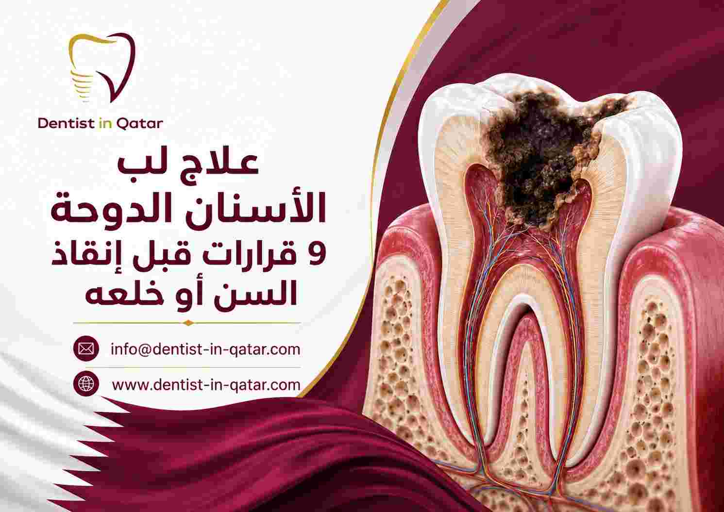 علاج لب الأسنان الدوحة