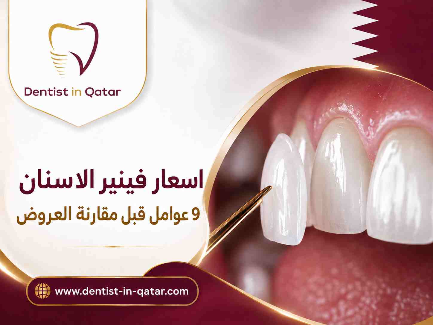 اسعار فينير الاسنان