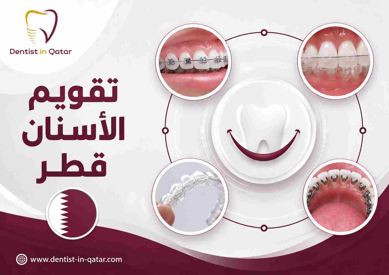 تقويم الأسنان قطر