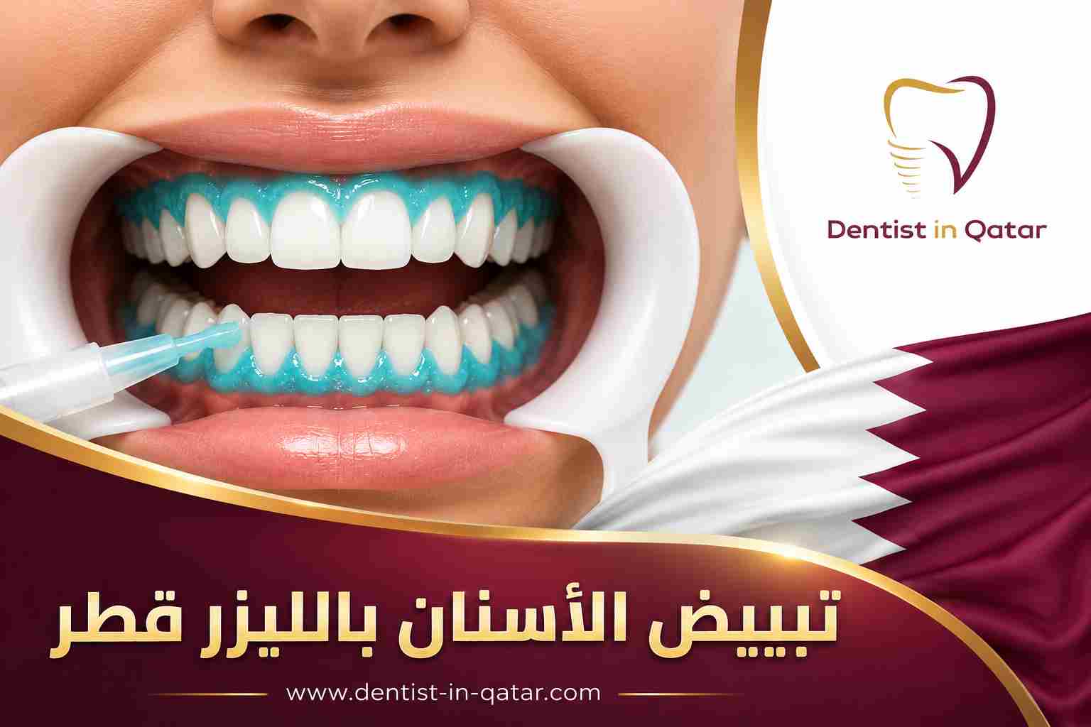 تبييض الأسنان بالليزر قطر