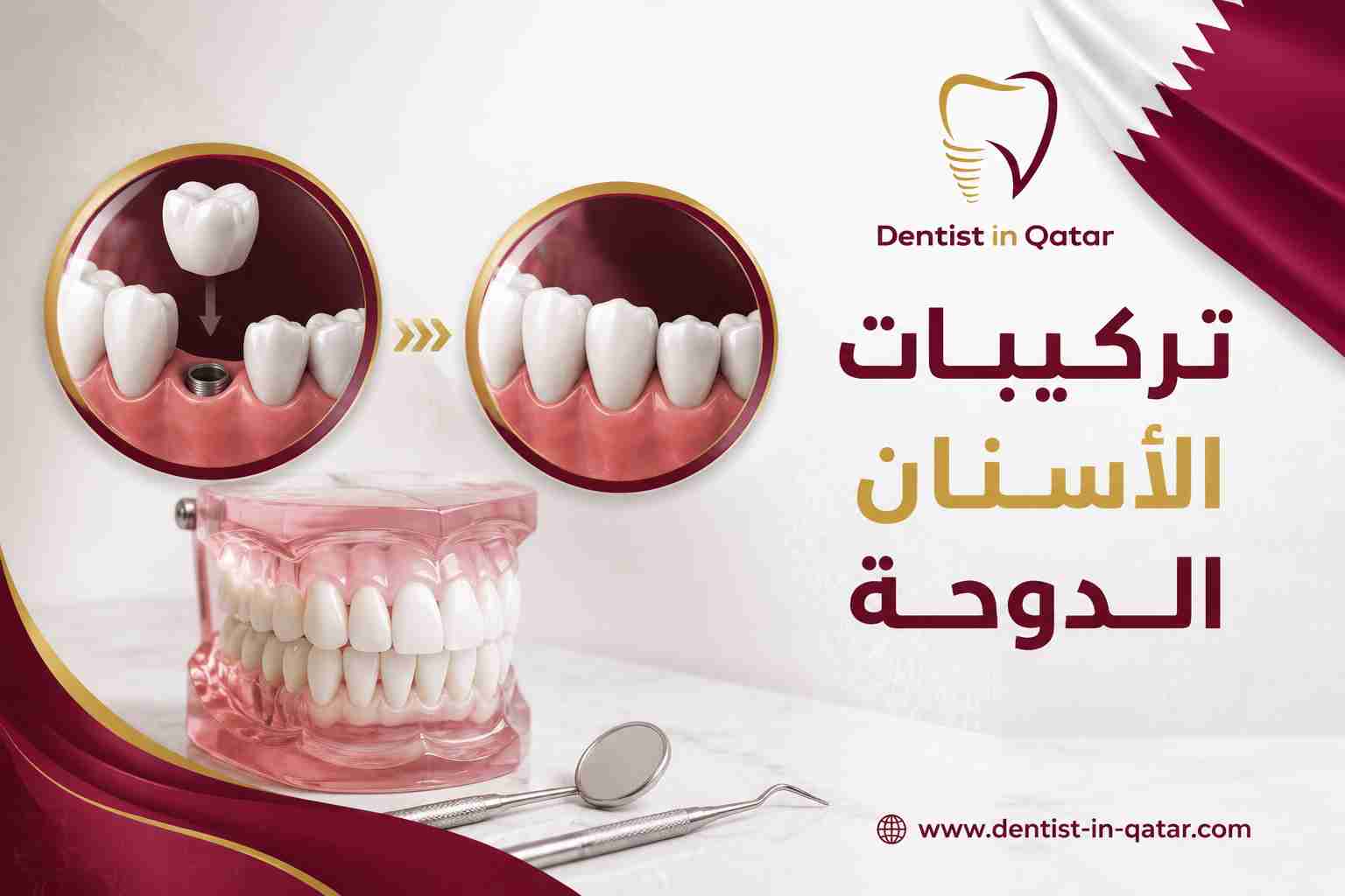 تركيبات الأسنان الدوحة