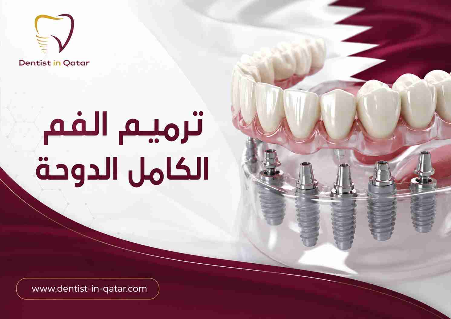 ترميم الفم الكامل الدوحة ترميم الفم الكامل الدوحة