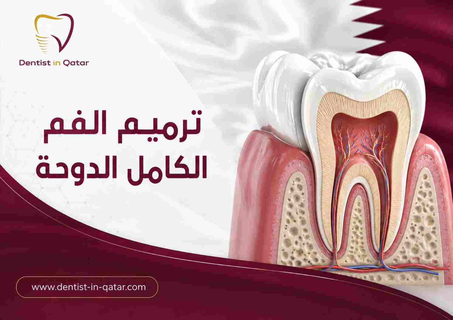 ترميم الفم الكامل الدوحة ترميم الفم الكامل الدوحة