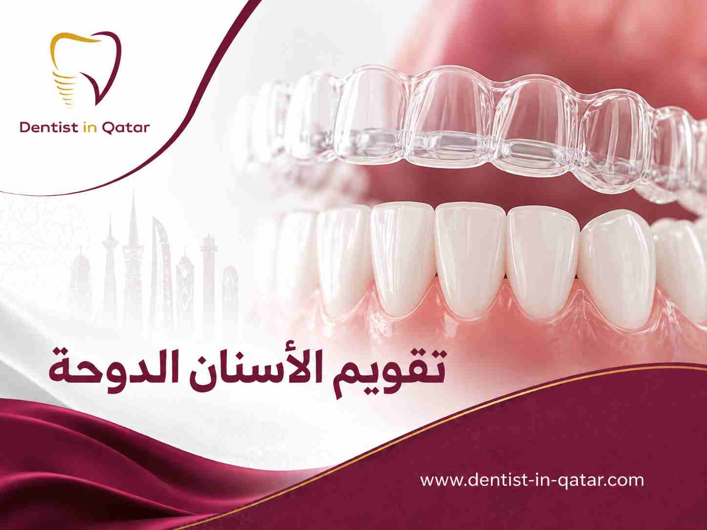 تقويم الأسنان الدوحة تقويم الأسنان الدوحة