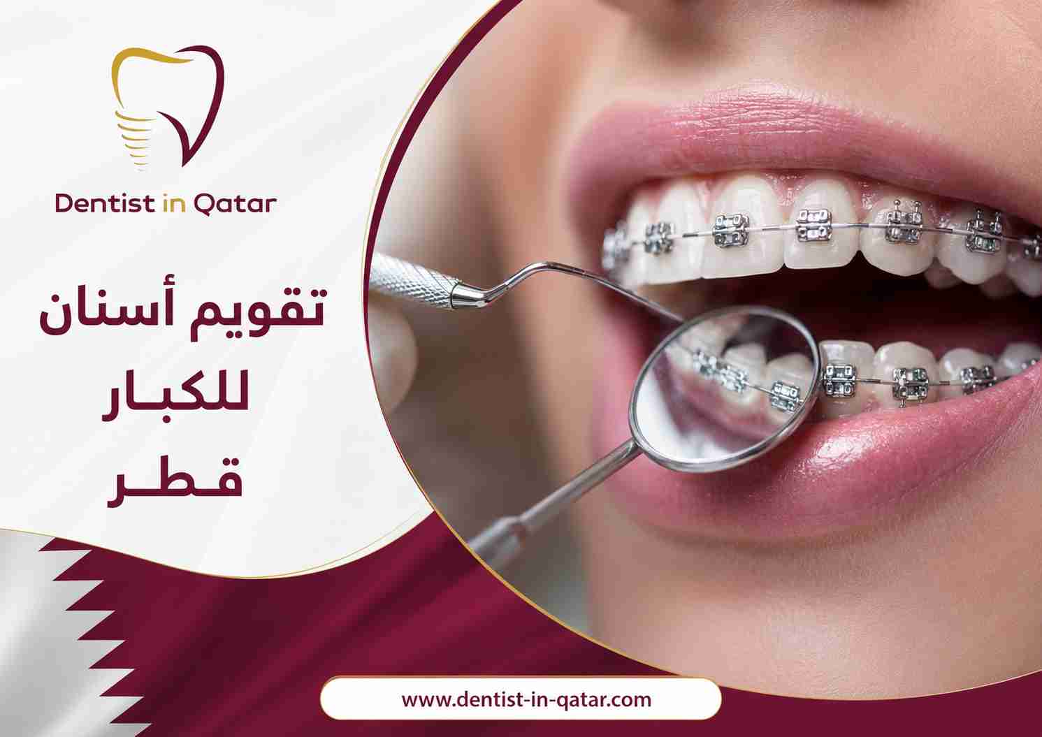 تقويم أسنان للكبار قطر
