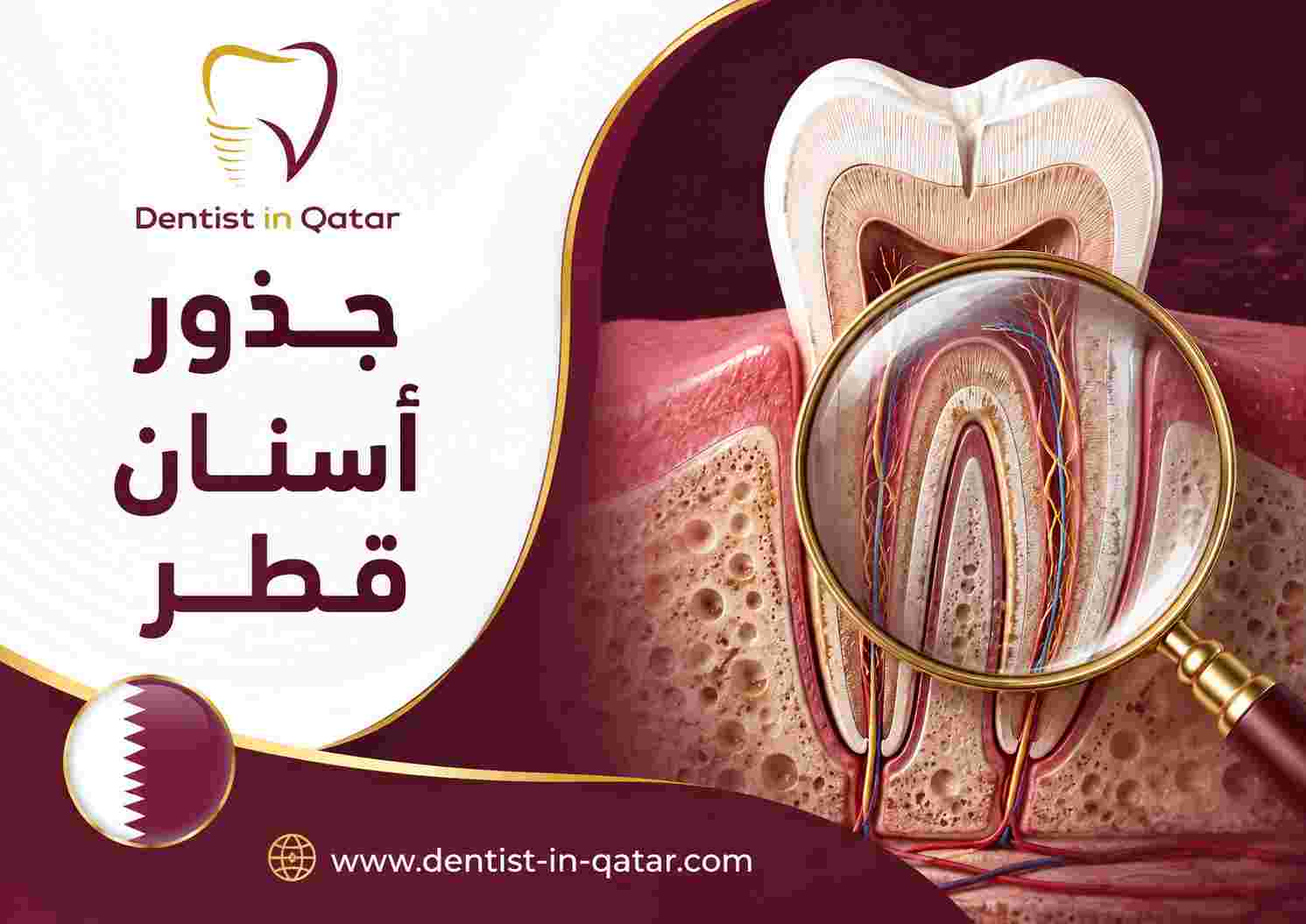جذور أسنان قطر
