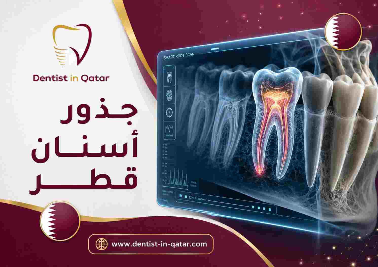 جذور أسنان قطر