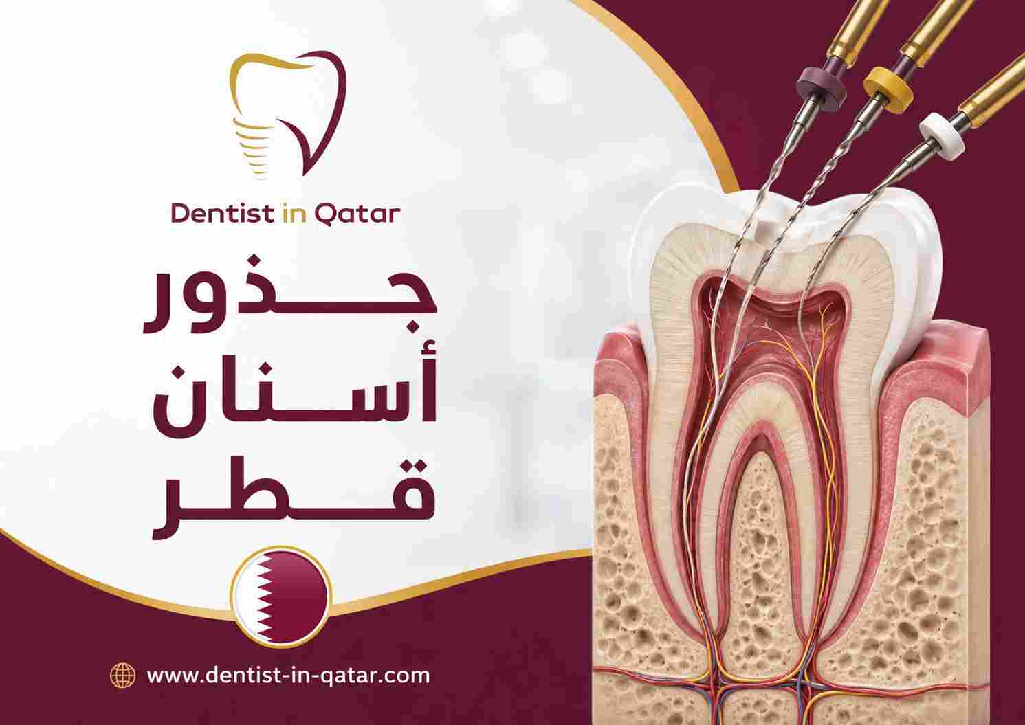 جذور أسنان قطر