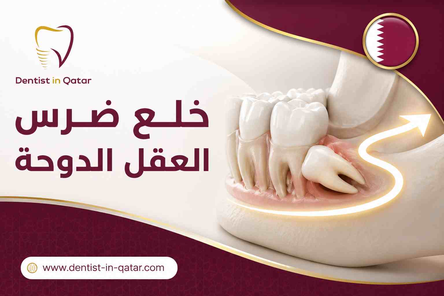 خلع ضرس العقل الدوحة