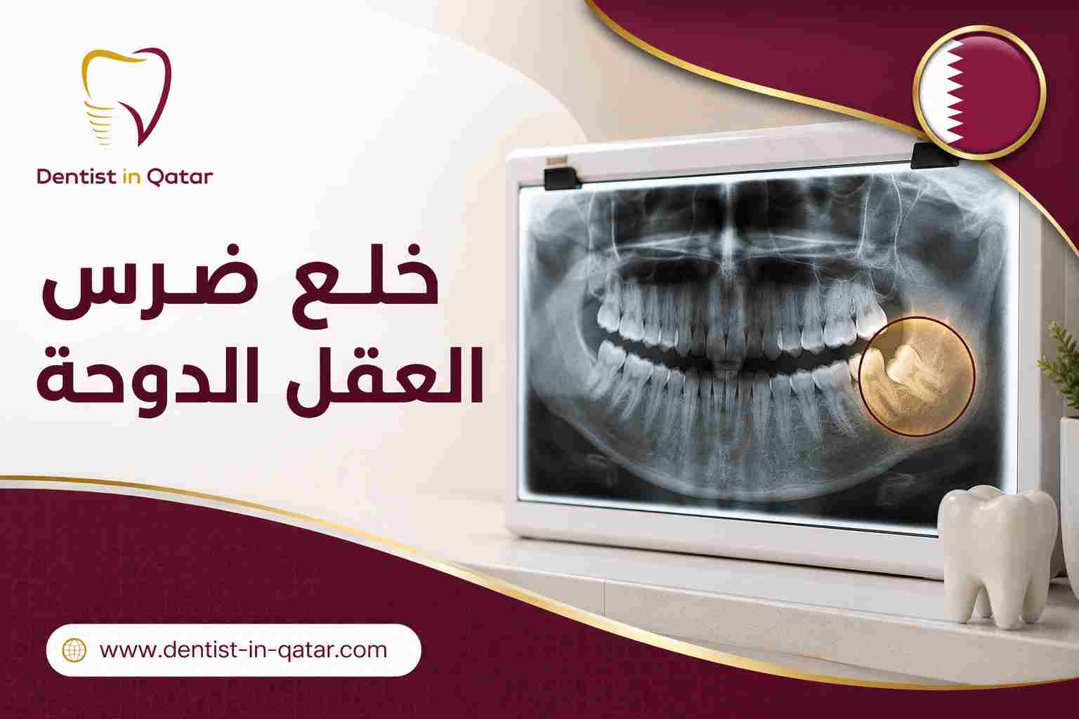 خلع ضرس العقل الدوحة