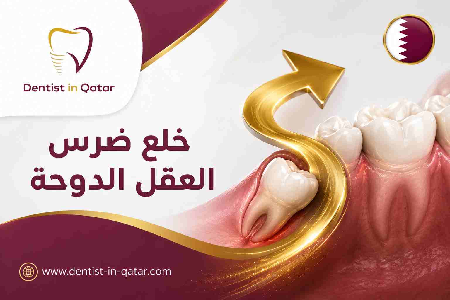 خلع ضرس العقل الدوحة