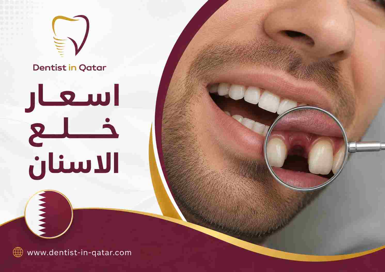 اسعار خلع الاسنان