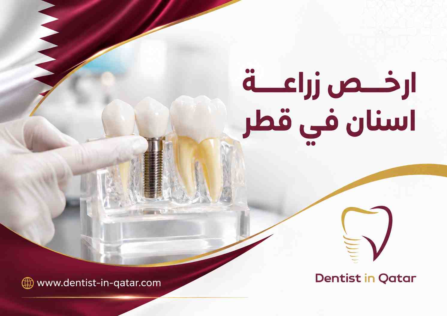 ارخص زراعة اسنان في قطر ارخص زراعة اسنان في قطر