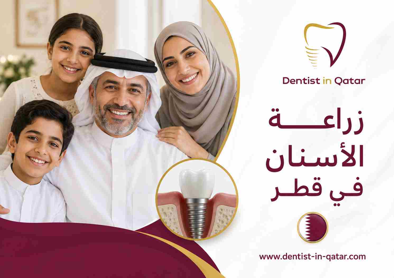 زراعة الأسنان في قطر زراعة الأسنان في قطر