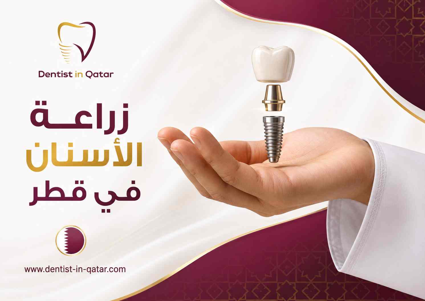زراعة الأسنان في قطر زراعة الأسنان في قطر