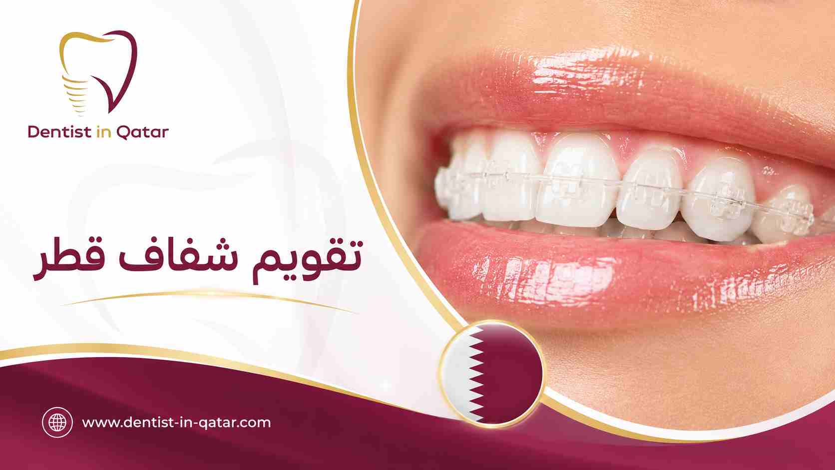 تقويم شفاف قطر تقويم شفاف قطر