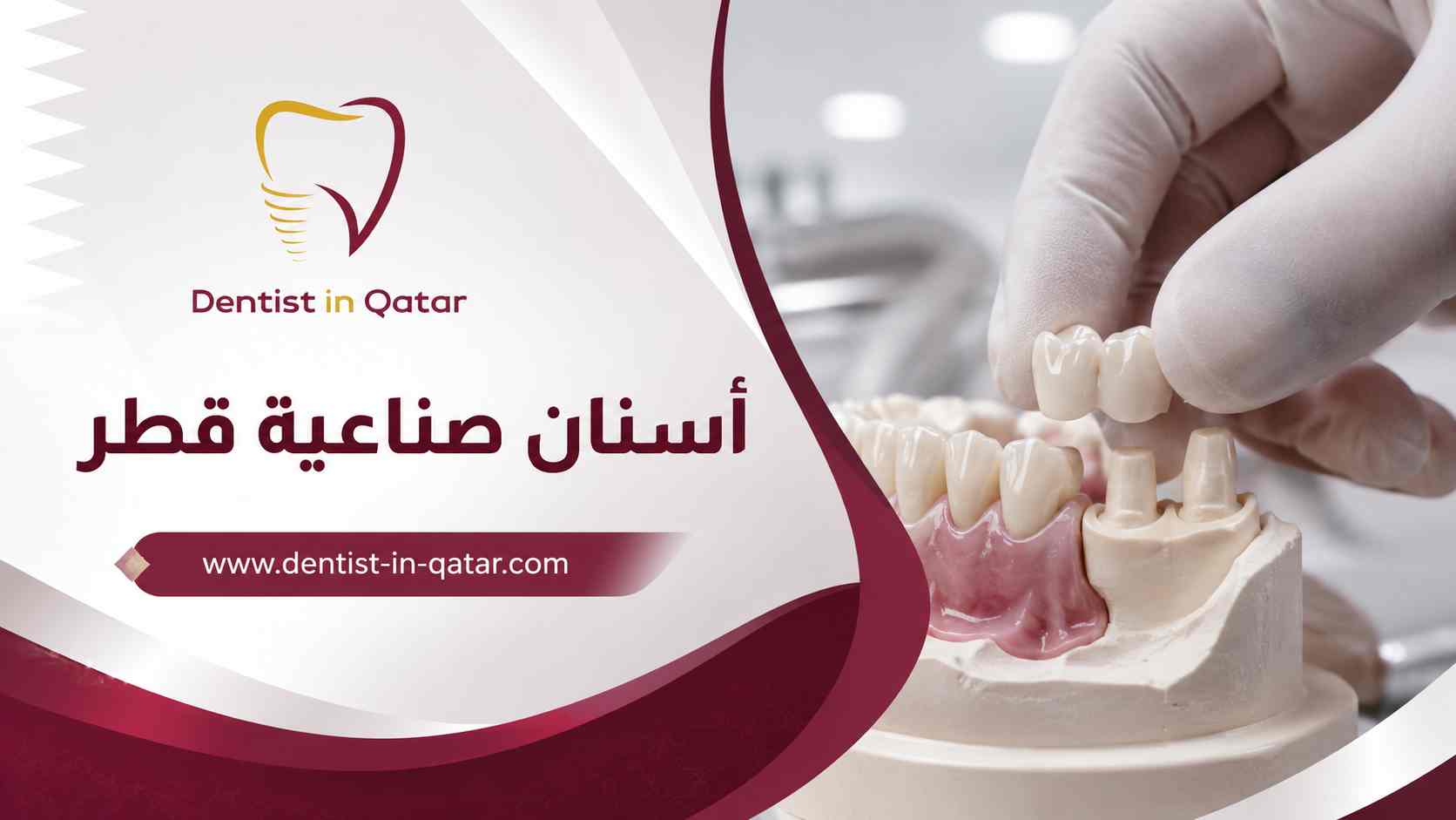 أسنان صناعية قطر