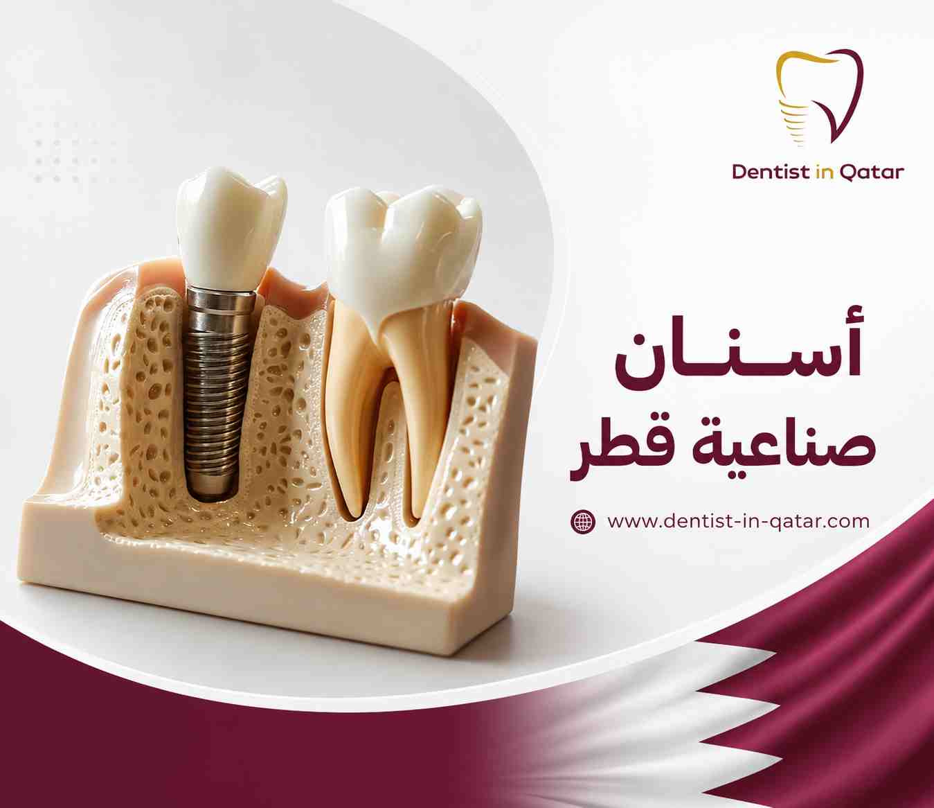 أسنان صناعية قطر