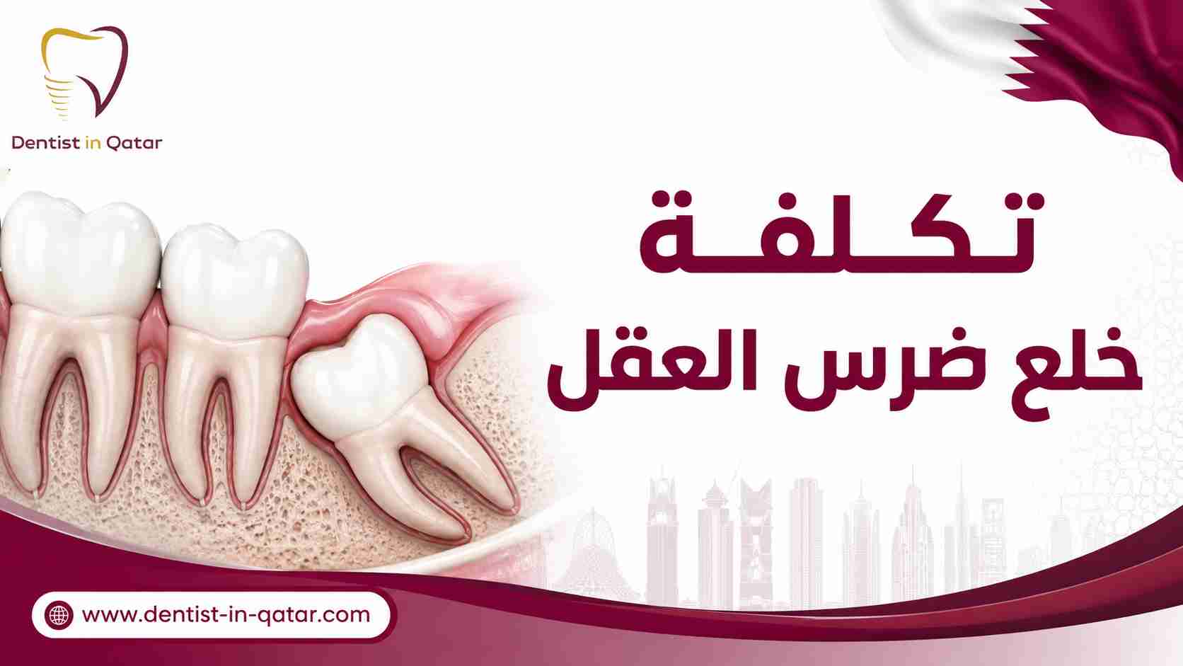 تكلفة خلع ضرس العقل