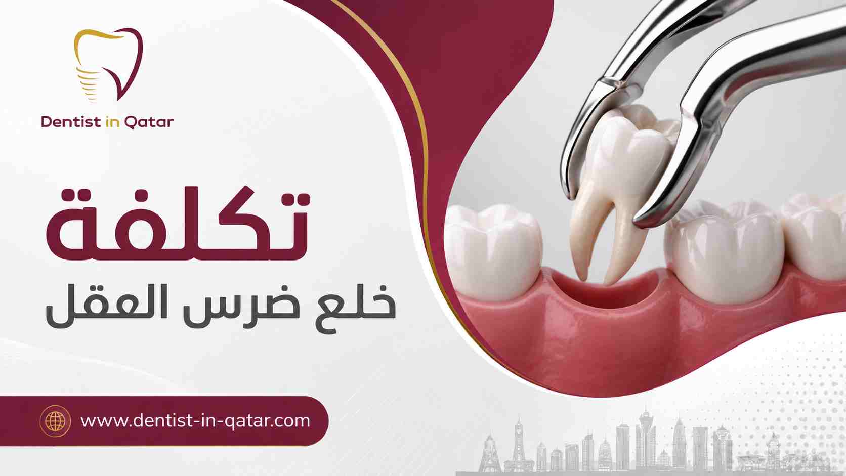 تكلفة خلع ضرس العقل